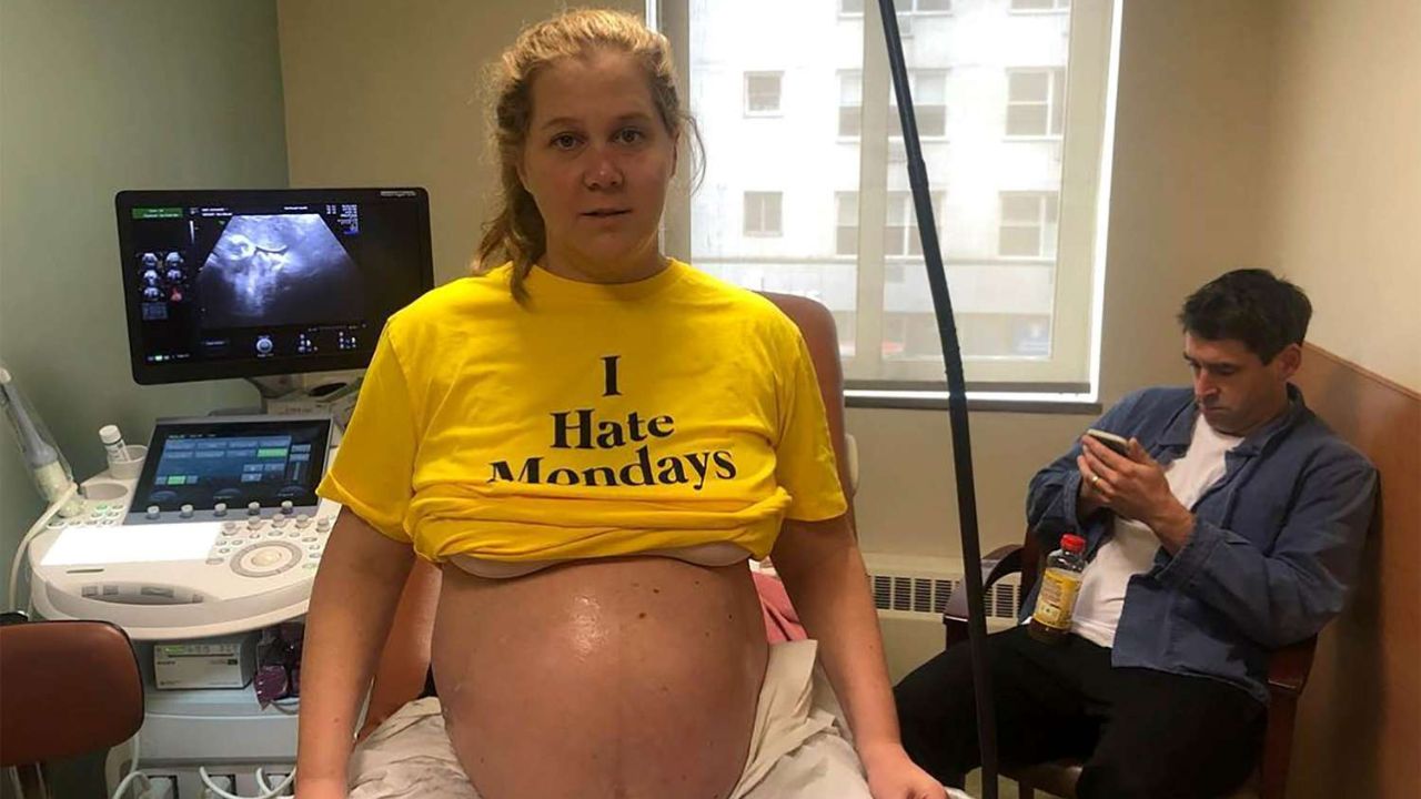 Is Amy Schumer Pregnant